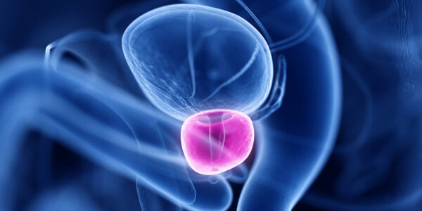 Prostatakrebs: Richtungsweisende Studien und Versorgungssituation